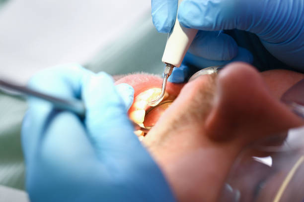Best Weekend Emergency Dentist in Colonial Heights, VA