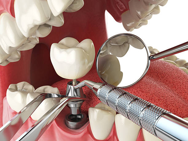 Best 24-Hour Emergency Dentist in Colonial Heights, VA