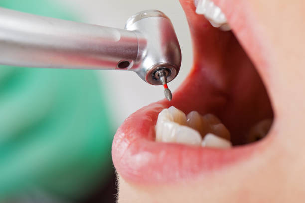 Best Pediatric Emergency Dentist in Colonial Heights, VA